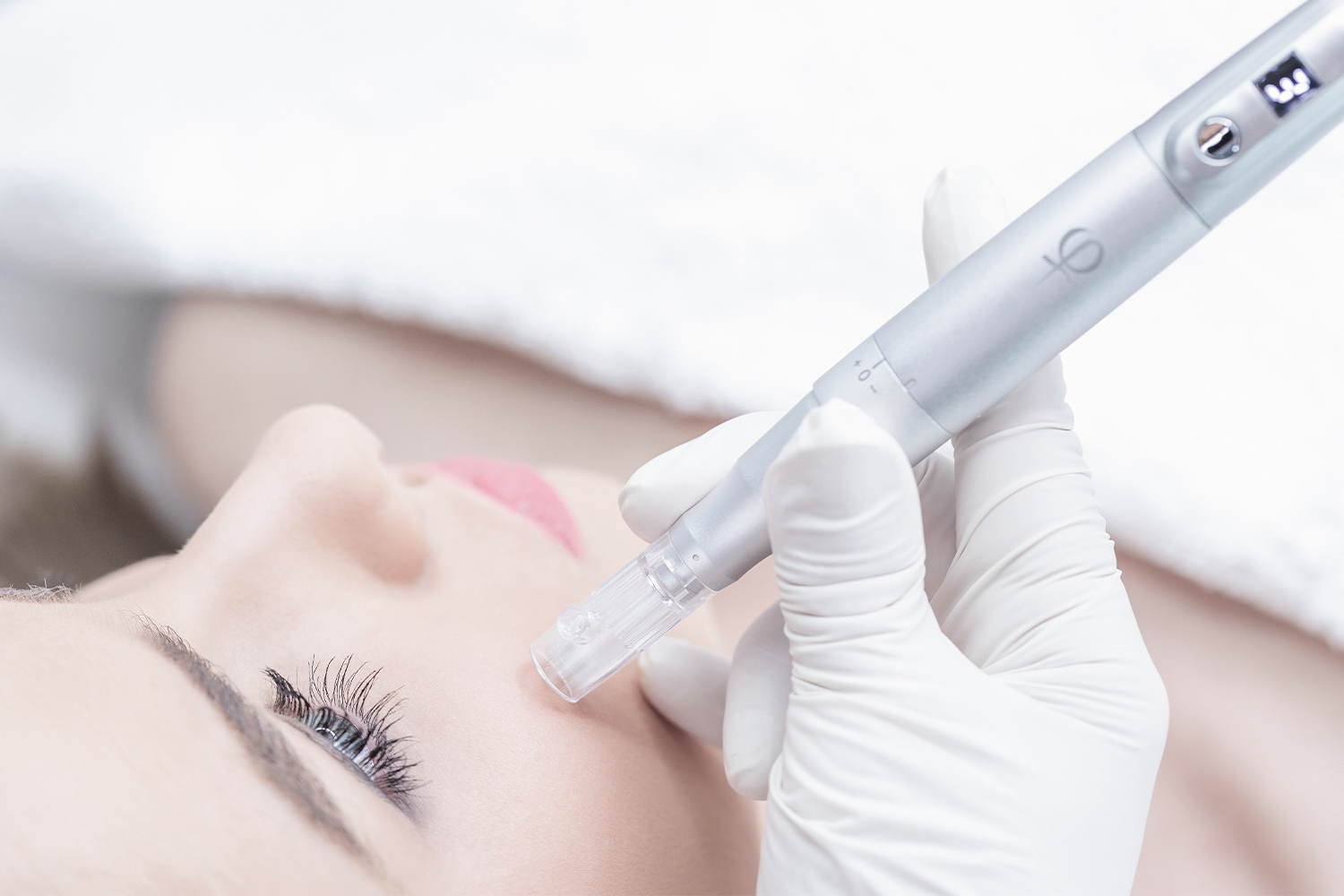 Microneedling procedure with dermapen Microneedling procedure with dermapen